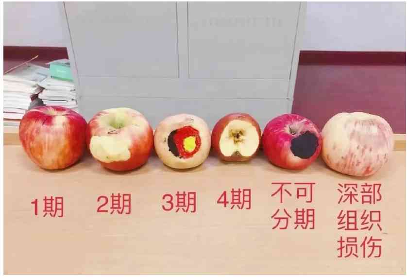 【科普促健康】世界压疮预防日，关注皮肤健康