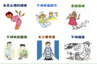 腰椎间盘突出症的日常指导