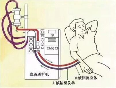 什么叫做血液透析?